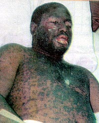 Burnt Georgie